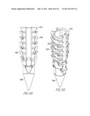 Tissue Repair Devices diagram and image