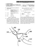 VARYING DIAMETER VASCULAR IMPLANT AND BALLOON diagram and image