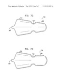 VARYING DIAMETER VASCULAR IMPLANT AND BALLOON diagram and image