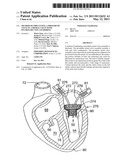 METHOD OF IMPLANTING A PROSTHETIC VALVE IN A MITRAL VALVE WITH PULMONARY VEIN ANCHORING diagram and image