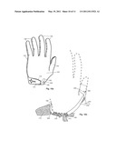 Protective Glove System diagram and image