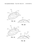 Contact lens materials, designs, substances, and methods diagram and image