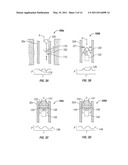 APPARATUS AND METHOD FOR DETECTING PRESSURE SIGNALS diagram and image