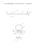 APPARATUS AND METHOD FOR DETECTING PRESSURE SIGNALS diagram and image