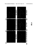 EDGE RINGING ARTIFACT SUPPRESSION METHODS AND APPARATUSES diagram and image