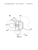 SUPPORT BAR FOR TURBINE DIAPHRAGM THAT FACILITATES REDUCED MAINTENANCE CYCLE TIME AND COST diagram and image