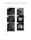 DEVICE AND METHOD FOR FLUORESCENCE-BASED IMAGING AND MONITORING diagram and image