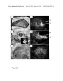 DEVICE AND METHOD FOR FLUORESCENCE-BASED IMAGING AND MONITORING diagram and image