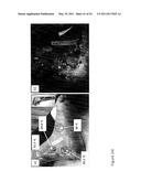 DEVICE AND METHOD FOR FLUORESCENCE-BASED IMAGING AND MONITORING diagram and image