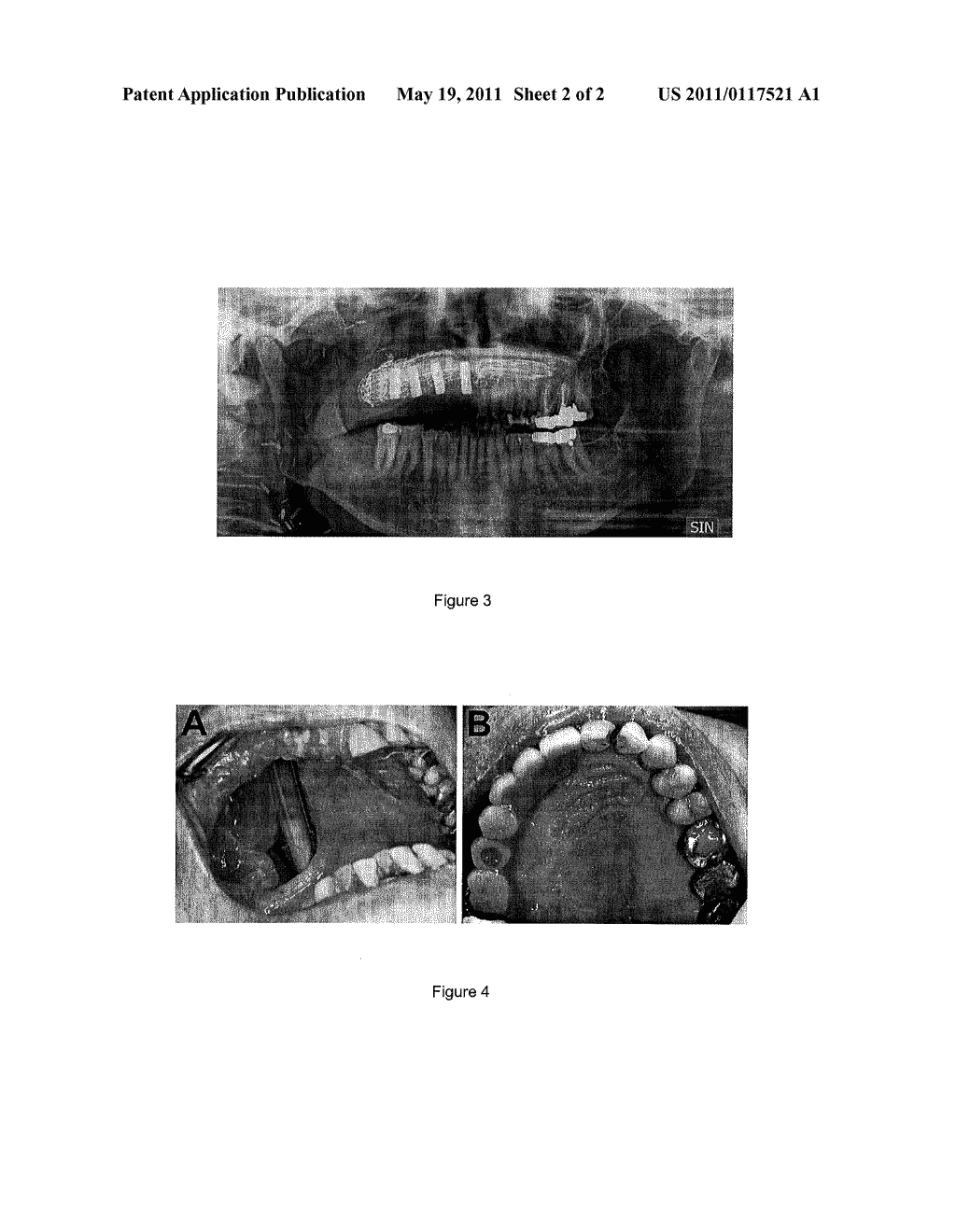 BIOLOGICAL REGENERATE - diagram, schematic, and image 03