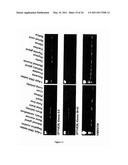 DIAGNOSIS OF HEREDITARY SPASTIC PARAPLEGIAS (HSP) BY IDENTIFICATION OF A MUTATION IN THE ZFYVE26 GENE OR PROTEIN diagram and image