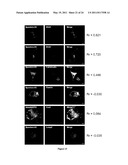 DIAGNOSIS OF HEREDITARY SPASTIC PARAPLEGIAS (HSP) BY IDENTIFICATION OF A MUTATION IN THE ZFYVE26 GENE OR PROTEIN diagram and image