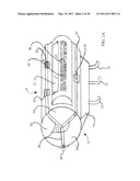 CONTAINMENT BARRIER FOR USE WITH SURFACE TREATMENT diagram and image