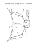 CONTAINMENT BARRIER FOR USE WITH SURFACE TREATMENT diagram and image