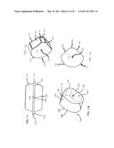 CONTAINMENT BARRIER FOR USE WITH SURFACE TREATMENT diagram and image