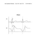 BLOOD VESSEL CHARACTERISTICS MEASURING APPARATUS AND BLOOD VESSEL CHARACTERISTICS MEASURING METHOD diagram and image