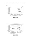 SYSTEMS AND METHODS FOR REPLACING SIGNAL ARTIFACTS IN A GLUCOSE SENSOR DATA STREAM diagram and image