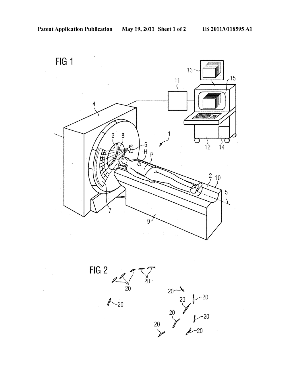 METHOD AND DEVICE FOR IDENTIFYING AND ASSIGNING CORONARY CALCIFICATION TO A CORONARY VESSEL AND COMPUTER PROGRAM PRODUCT - diagram, schematic, and image 02