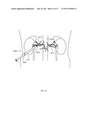 Targeted Inhibition of Physiologic and Pathologic Processes diagram and image