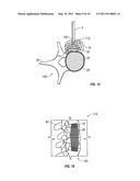 Spinous Navigation System and Associated Methods diagram and image