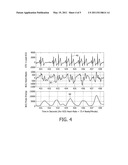 BALLISTOCARDIOGRAM ANALYSIS METHOD AND DEVICE diagram and image