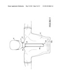 METHOD FOR TREATING A USER S BACK OR NECK USING A TRACTION SYSTEM diagram and image