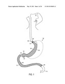 METHOD AND APPARATUS FOR TREATING OBESITY AND CONTROLLING WEIGHT GAIN AND ABSORPTION OF GLUCOSE IN MAMMALS diagram and image