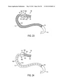 METHOD AND APPARATUS FOR TREATING OBESITY AND CONTROLLING WEIGHT GAIN AND ABSORPTION OF GLUCOSE IN MAMMALS diagram and image