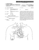 CANNULA STABILIZER diagram and image