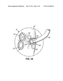 CANNULA STABILIZER diagram and image