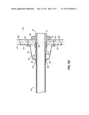 CANNULA STABILIZER diagram and image