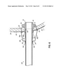 CANNULA STABILIZER diagram and image