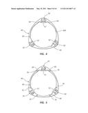 OVERMOLDED ACCESS PORT INCLUDING ANCHORING AND IDENTIFICATION FEATURES diagram and image