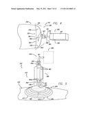 REDUCED PRESSURE TREATMENT SYSTEM diagram and image