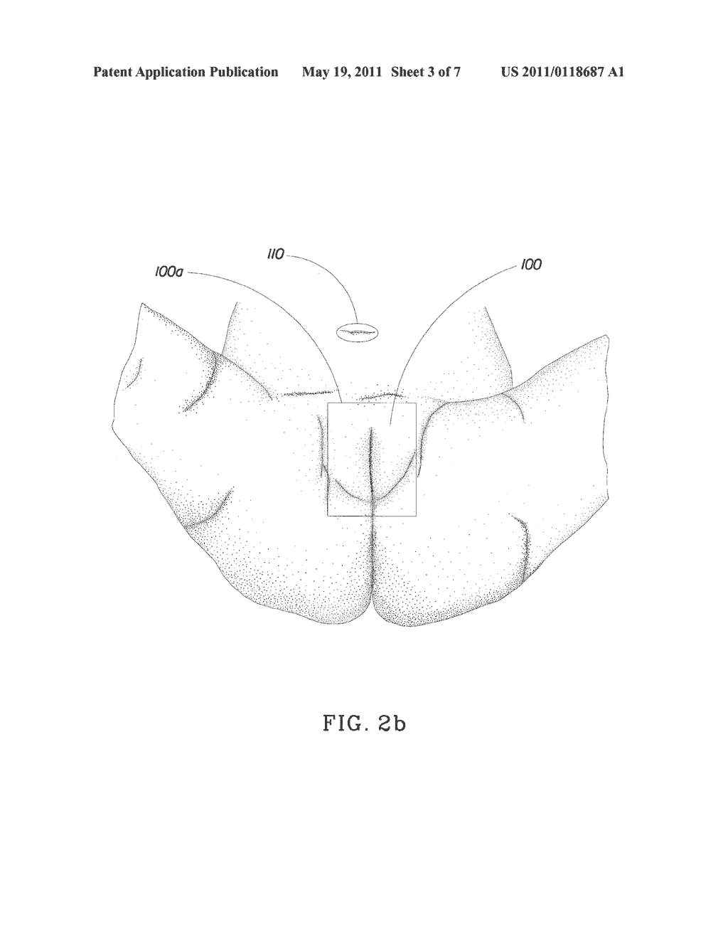 Absorbent Article and Method for Maintaining or Improving Skin Health - diagram, schematic, and image 04