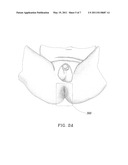 Absorbent Article and Method for Maintaining or Improving Skin Health diagram and image