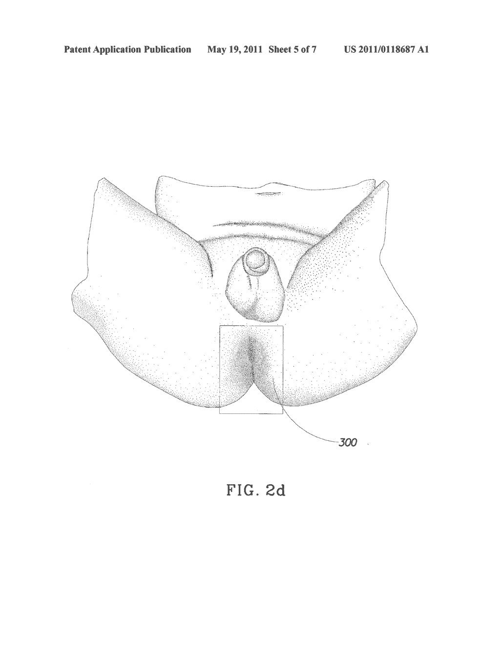 Absorbent Article and Method for Maintaining or Improving Skin Health - diagram, schematic, and image 06