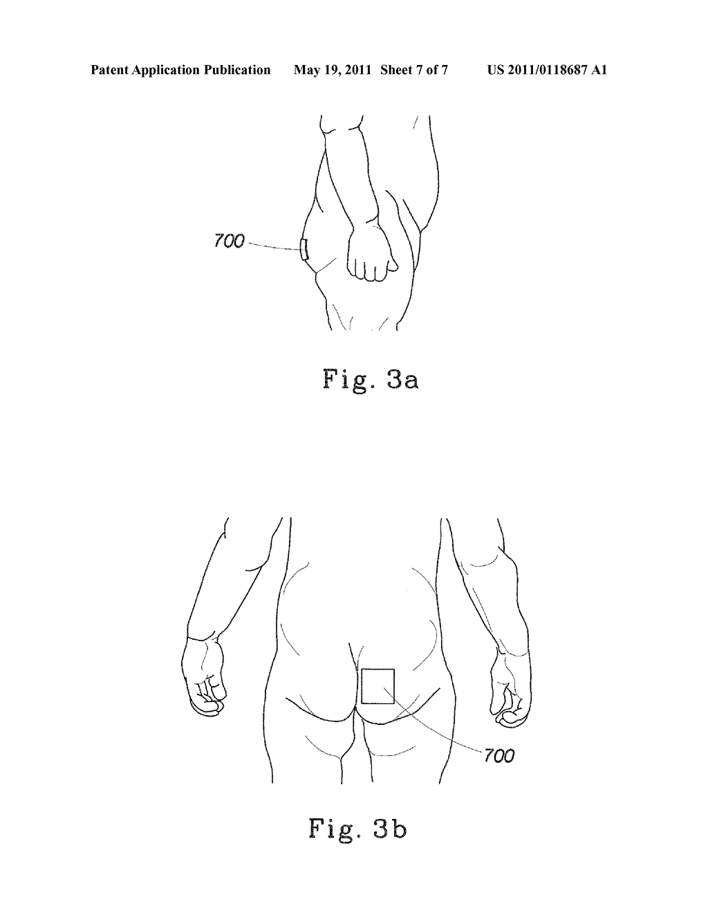 Absorbent Article and Method for Maintaining or Improving Skin Health - diagram, schematic, and image 08