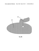  Device Suitable for Use During Deployment of a Medical Device diagram and image