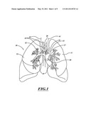 NON-INVASIVE AND MINIMALLY INVASIVE DENERVATION METHODS AND SYSTEMS FOR PERFORMING THE SAME diagram and image