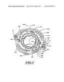 NON-INVASIVE AND MINIMALLY INVASIVE DENERVATION METHODS AND SYSTEMS FOR PERFORMING THE SAME diagram and image