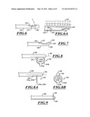 NON-INVASIVE AND MINIMALLY INVASIVE DENERVATION METHODS AND SYSTEMS FOR PERFORMING THE SAME diagram and image