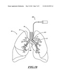 NON-INVASIVE AND MINIMALLY INVASIVE DENERVATION METHODS AND SYSTEMS FOR PERFORMING THE SAME diagram and image