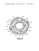 NON-INVASIVE AND MINIMALLY INVASIVE DENERVATION METHODS AND SYSTEMS FOR PERFORMING THE SAME diagram and image