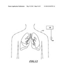 NON-INVASIVE AND MINIMALLY INVASIVE DENERVATION METHODS AND SYSTEMS FOR PERFORMING THE SAME diagram and image