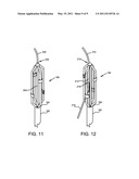 ASSEMBLY OF STAGGERED ABLATION ELEMENTS diagram and image