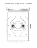 CONTROLLED IRREVERSIBLE ELECTROPORATION diagram and image