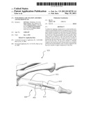 Intramedullary fixation assembly and method of use diagram and image