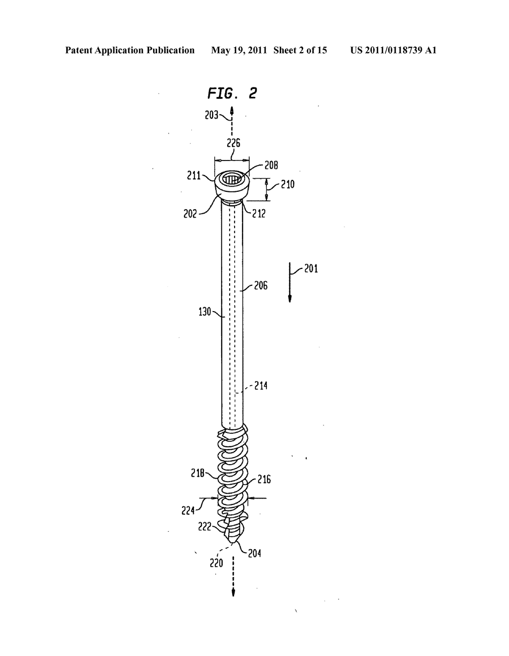 Intramedullary fixation assembly and method of use - diagram, schematic, and image 03