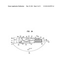 Intramedullary fixation assembly and method of use diagram and image